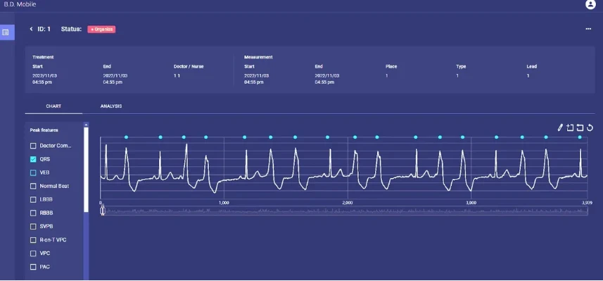 BD-CARdio ECG dashboard with QRS/VEB peak-feature analysis